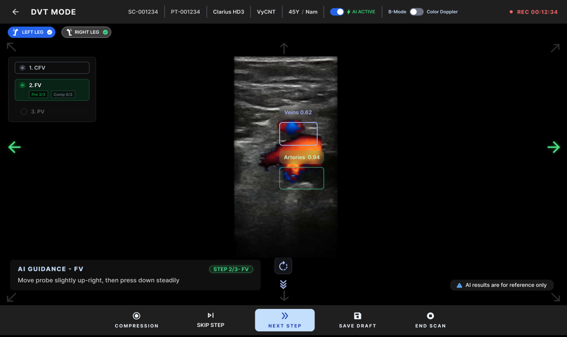 Sonomate DVT guidance console